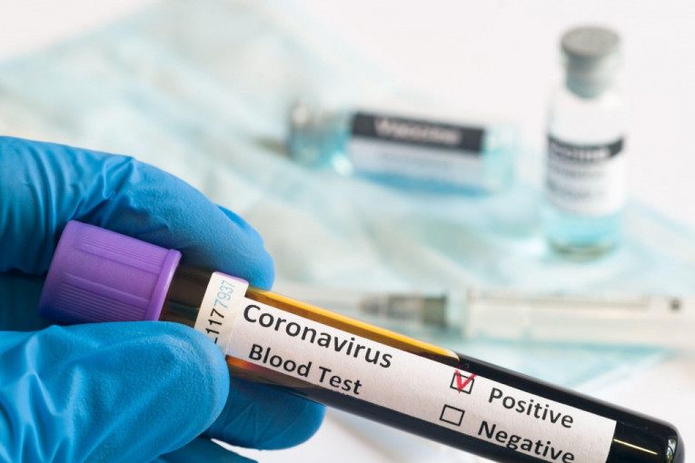 I ovo je moguće: Istovremeno možemo biti inficirani sa više sojeva koronavirusa, upozoravaju stručnjaci!