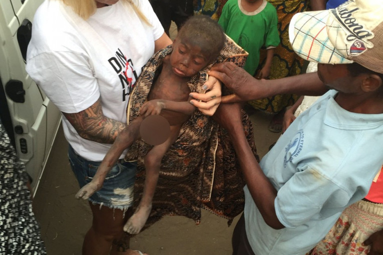Potresna fotografija dečaka iz Nigerije, ostavljenog da umre od gladi, rasplakala je svet, danas će vam se vratiti osmeh na lice
