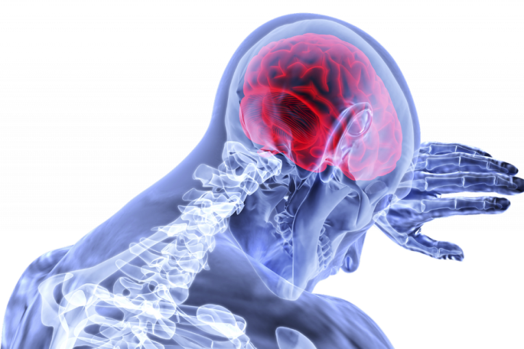 Korona opasna i posle izlečenja: Mozak najugroženiji, dva poremećaja najčešća