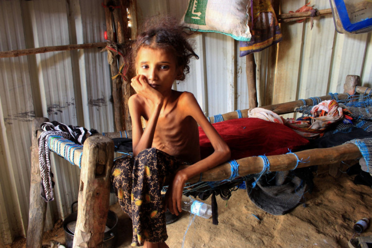 Crne prognoze UN: Više od dva miliona jemenske dece će biti neuhranjeno ove godine (FOTO)