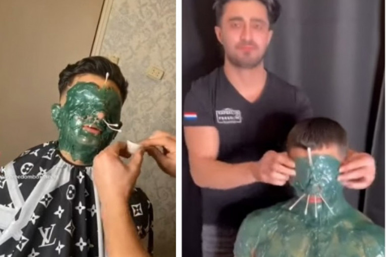 Novi trend - depilacija celog lica: Iz poznate berbernice izlaze bez ijedne dlake, stručnjaci upozoravaju na opasnosti (VIDEO)