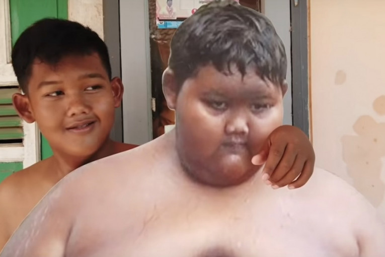 Sa 11 godina bio je najdeblji dečak na svetu, a do sada je oslabio 110 kilograma! (VIDEO)