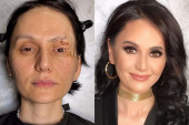 Ruska šminkerka dokazuje da svaka žena može biti holivudska diva: Uspešno "krije" ožiljke i bubuljice, a transformacije su neverovatne