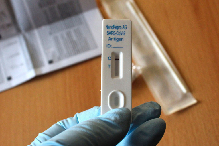 PCR testovi su prošlost? Rezultat novog kovid testa za samo 3 minuta!