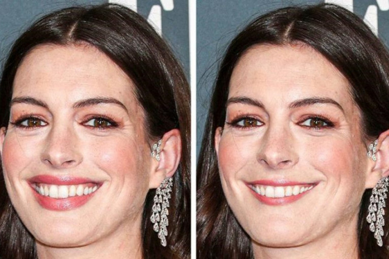 Fotografije slavnih žena pokazuju kako veličina usana drastično menja izgled lica