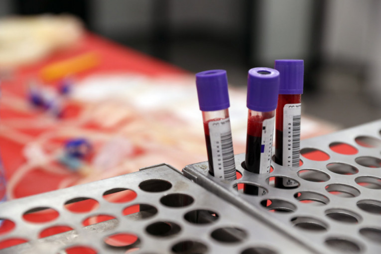 Institut za transfuziju krvi: Drastično smanjene rezerve, nedostaju sve krvne grupe