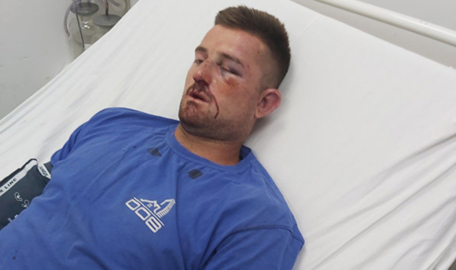 Prebijanje, ranjavanje i maltretiranje: Ovako je Srbima sa Kosmeta izgledala ova godina