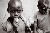 Rascepljeno nepce, usne, pa i neki organi: Strahota u Kongu, sve više dece se rađa sa manama, a sve zbog...