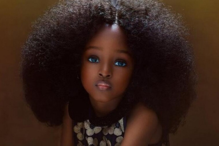 Sa pet godina proglašena za najlepšu na svetu: Kako sada izgleda prelepa nigerijska devojčica?