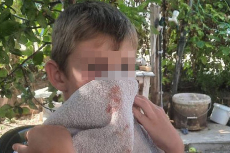 Ovo je dečak kog su napali Albanci: Opkolili su ga dok se vraćao iz prodavnice i mučki prebili (FOTO)