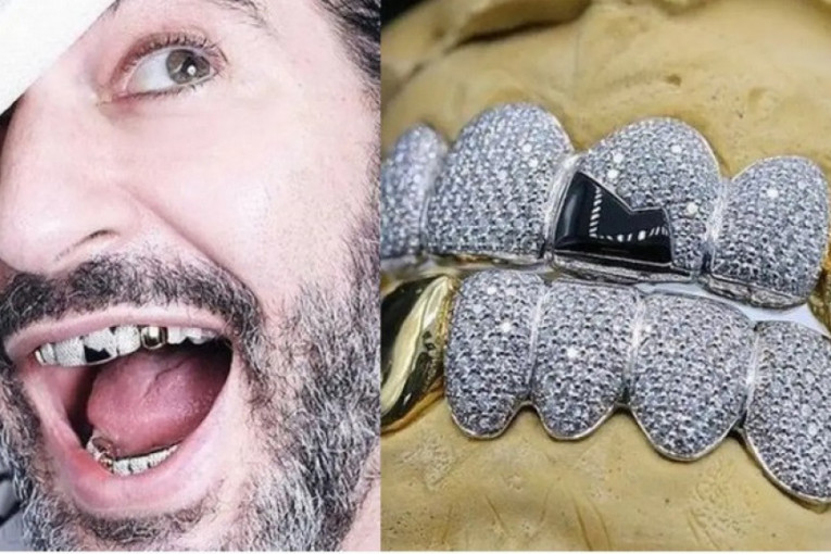 Ukras za osmeh: Mark Džejkobs ima nove navlake za zube sa dijamantima