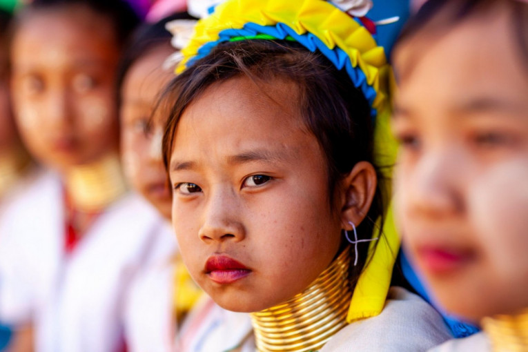 Od crnih zuba do izduženog vrata: Osam neobičnih standarda lepote u zemljama Azije (FOTO)