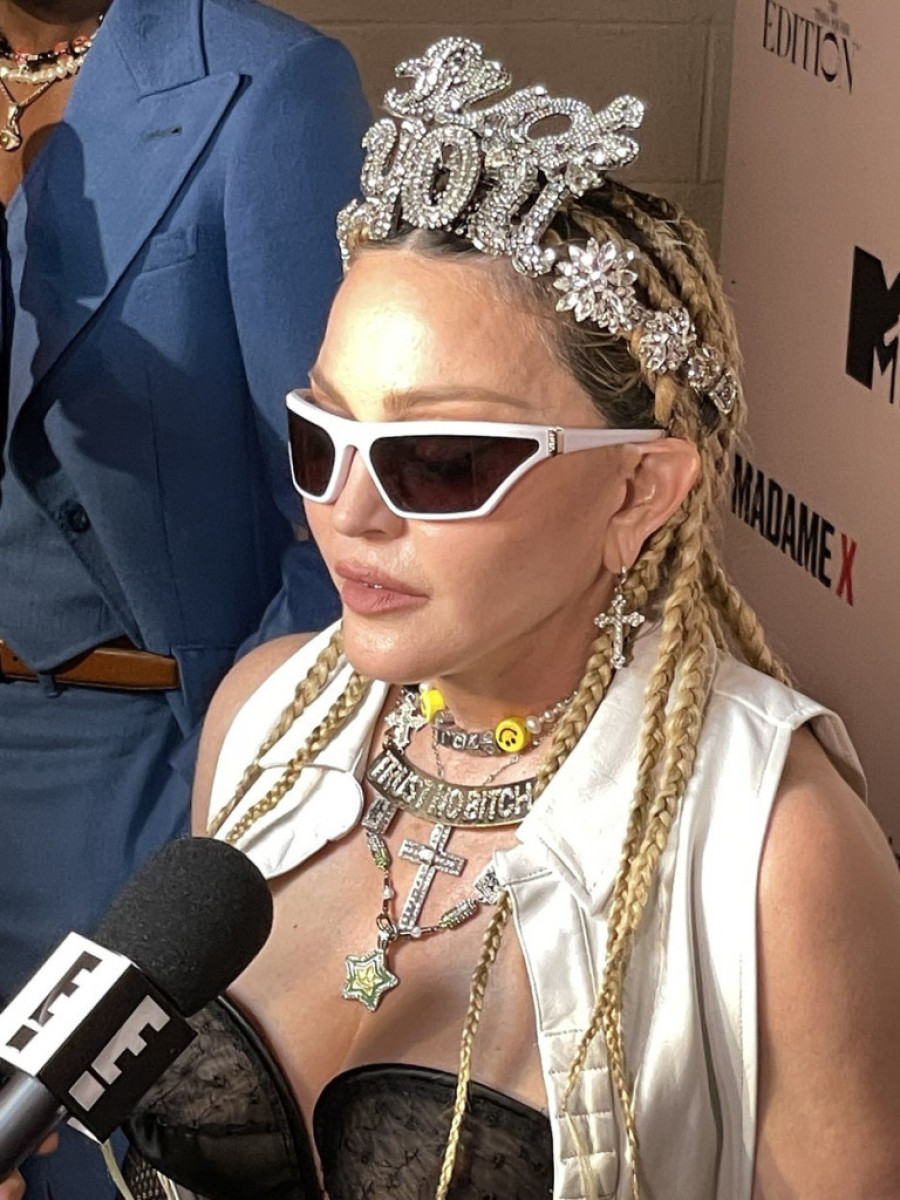 Kao veverice! Tom Kruz i Madona izobličeni od botoksa, estetski stručnjaci progovorili o izgledu zvezda