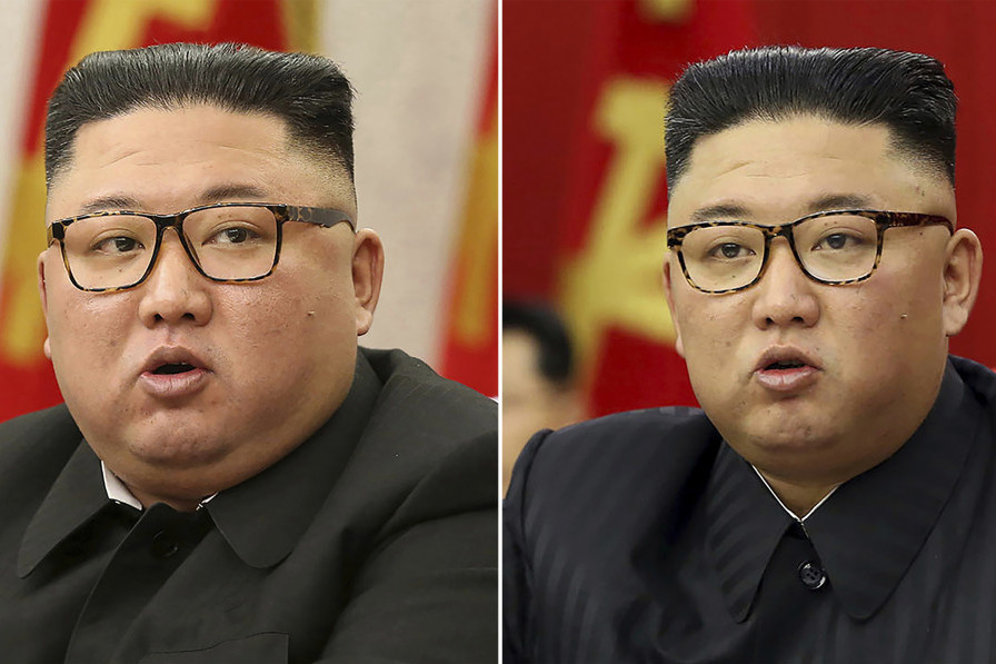 Kim nije imao dvojnika, samo je smršao 20 kilograma: Saopšteni detalji zdravstvenog stanja lidera Severne Koreje