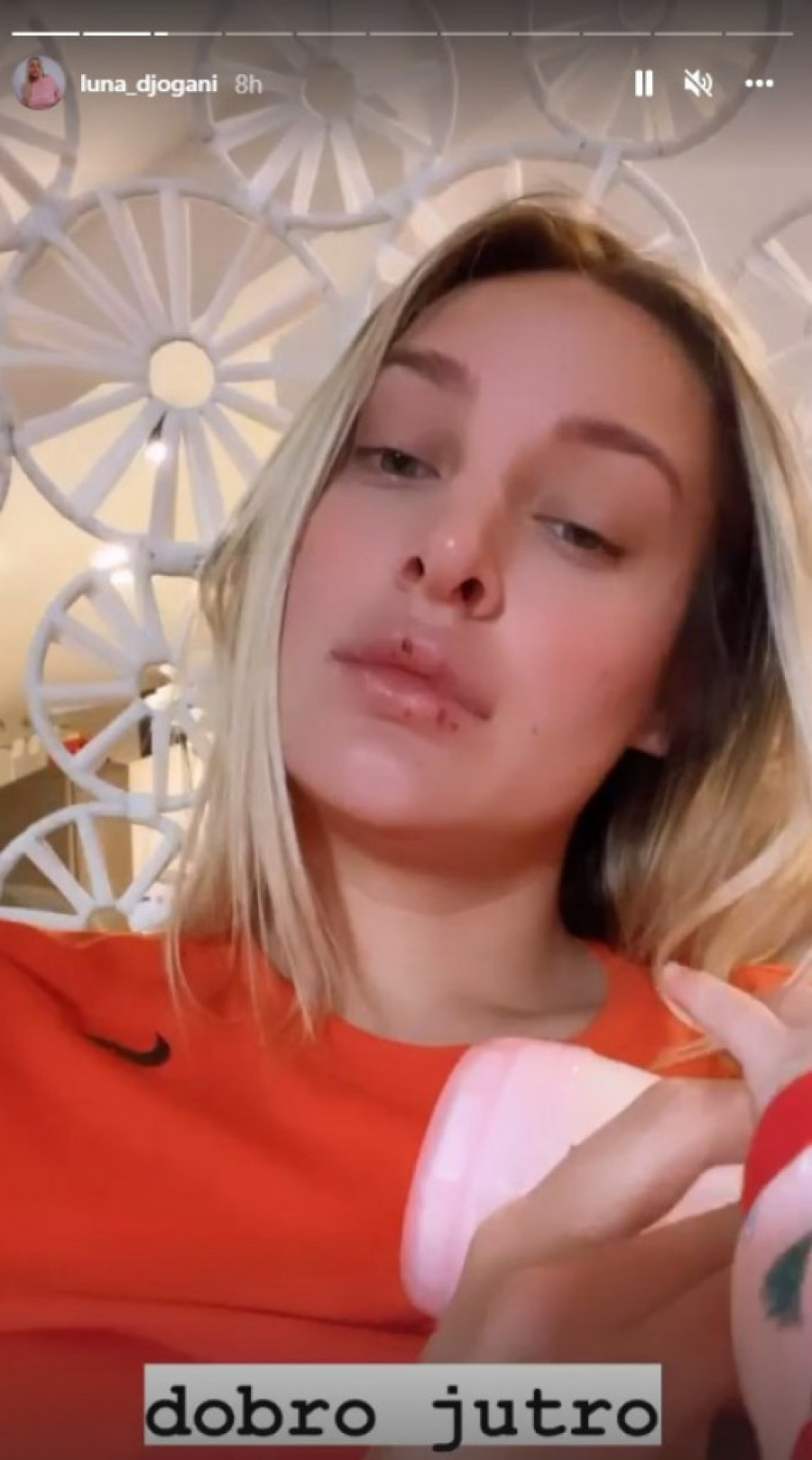 Da objasnim dušebrižnicima: Luna sve zabrinula slikom krvavih usana, pa brzo dala obrazloženje (FOTO)