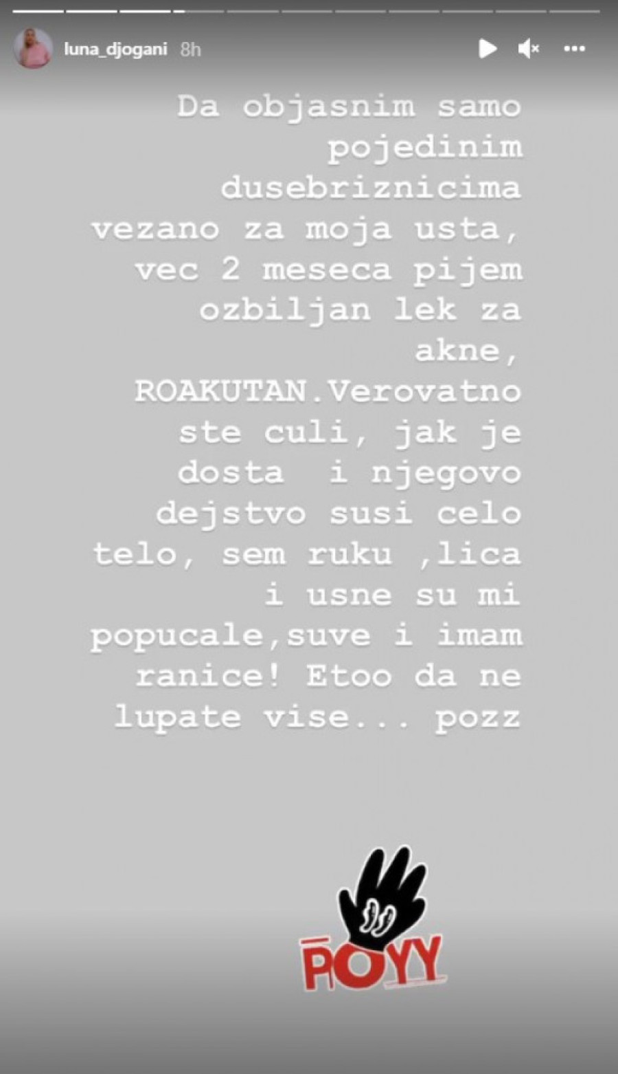Da objasnim dušebrižnicima: Luna sve zabrinula slikom krvavih usana, pa brzo dala obrazloženje (FOTO)