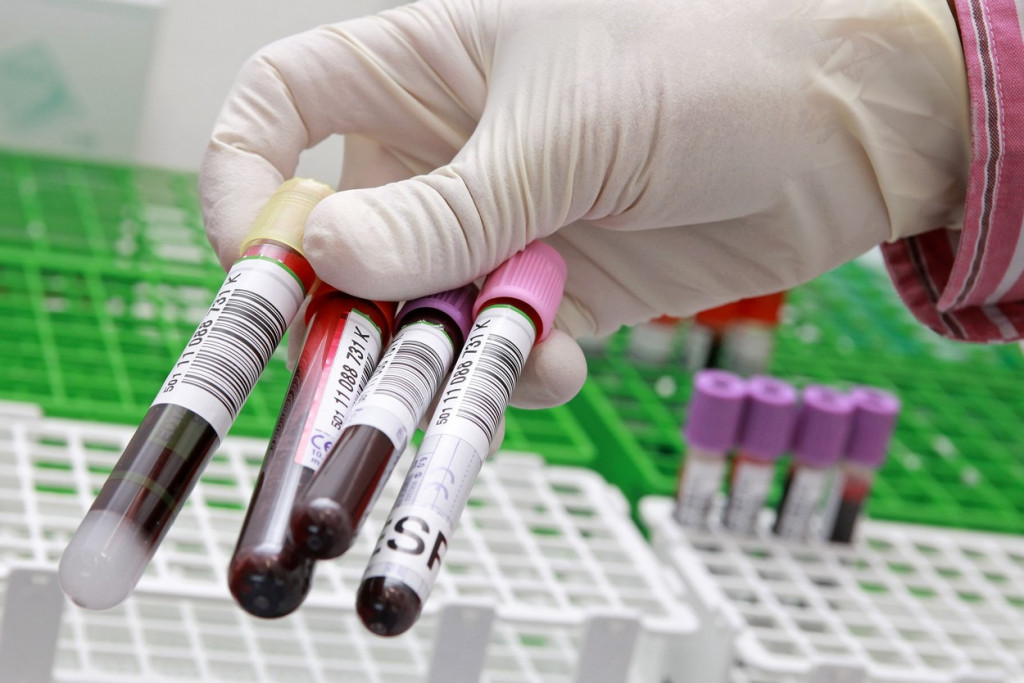 Otkriven ključ koji može spasiti milione života! Naučnici uzgajaju "zlatnu krv"