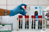 Alarmantno: U Srbiji oko 3.000 ljudi s HIV-om