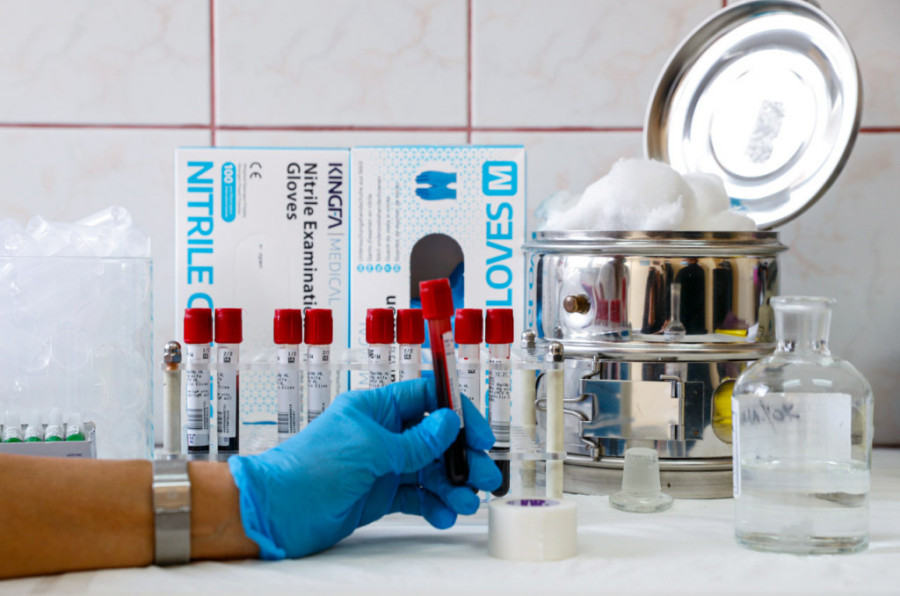 "Kinem zbog alergije, oni pomisle - umirem sutra!" Pre 15 godina je saznao da ima HIV, a sve je počelo od nezaštićenog odnosa!