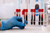 24SEDAM PANČEVO Besplatno testiranje na HIV 1. decembra