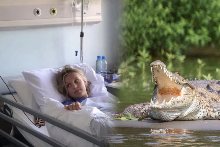 Tinejdžerka čudom preživela napad krokodila: Stopalo joj je visilo, ali se hrabro izborila sa predatorom (VIDEO)