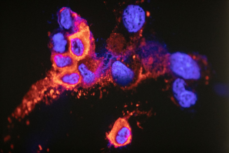 Omikron se pojavio i u južnoj pokrajini: Na Kosovu i Metohiji čak devetoro zaraženih
