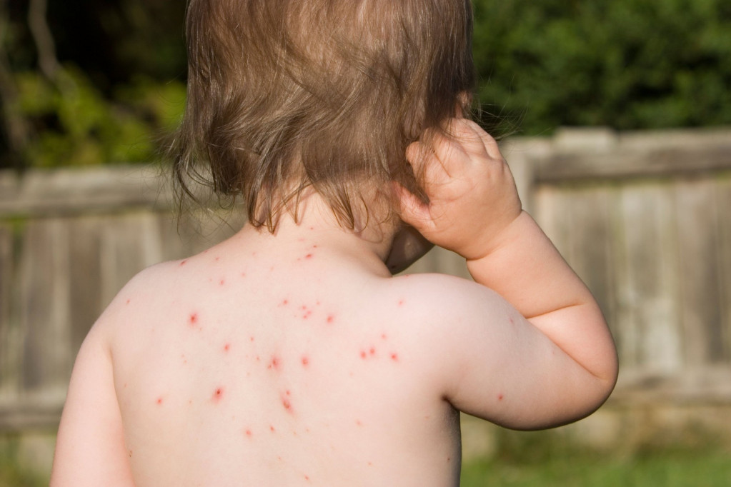 Posle korone nas čeka još jedna ozbiljna bolest: Epidemilog otkriva šta nam se sprema nakon pandemije