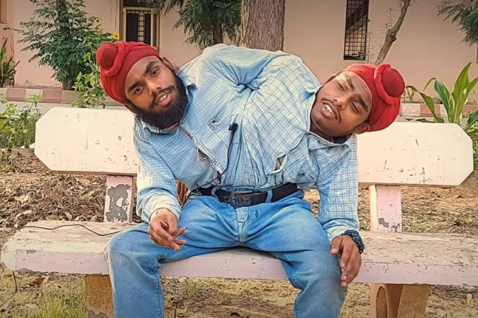 Sijamski blizanci koje su roditelji napustili kao bebe, dobili su svoj posao iz snova