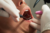 Bojite se da posetite zubara? Stručnjak otkrio u kom delu dana manje boli