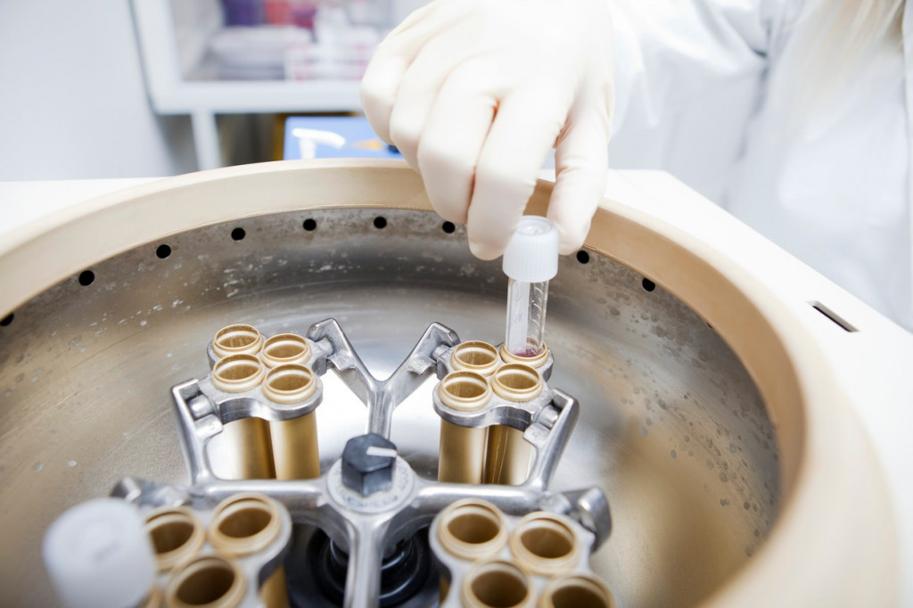 Bizarno: Miloš testamentom ostavio spermu majci, doktori rekli da će je uništiti, pa je sve stiglo i do suda