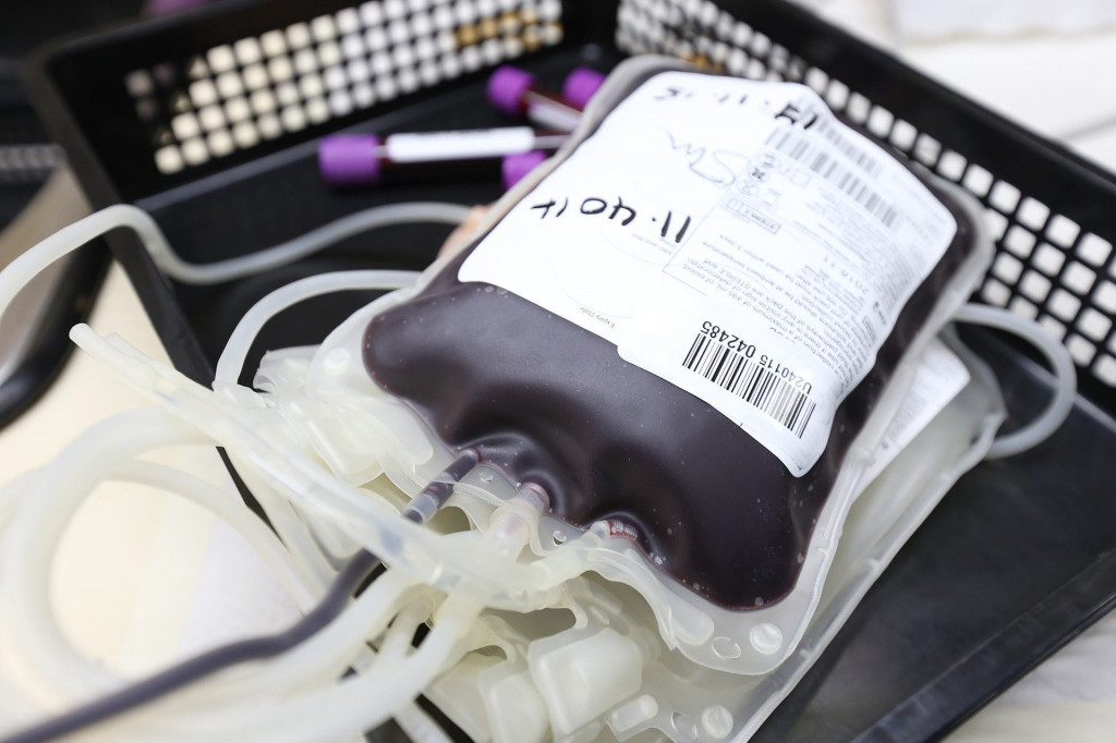 Tokom prazničnog vikenda smanjene zalihe krvi! Iz Instituta apeluju - donirajte krv, nedostaju nulta pozitivna i A pozitivna krvna grupa