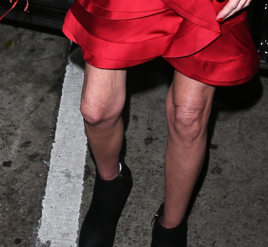 Kost i koža: Glumica zaprepastila izgledom, a nekad su svi bili zaljubljeni u nju (FOTO)