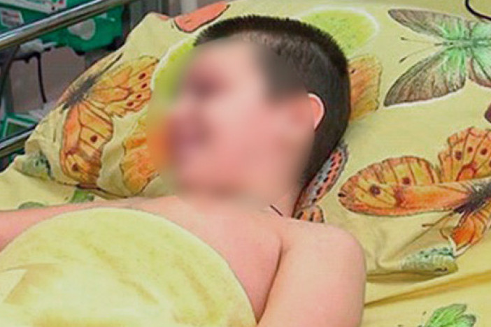 Bolnica o povredi dečaka kome je u oko iscurio lepak: "Neće biti posledica"