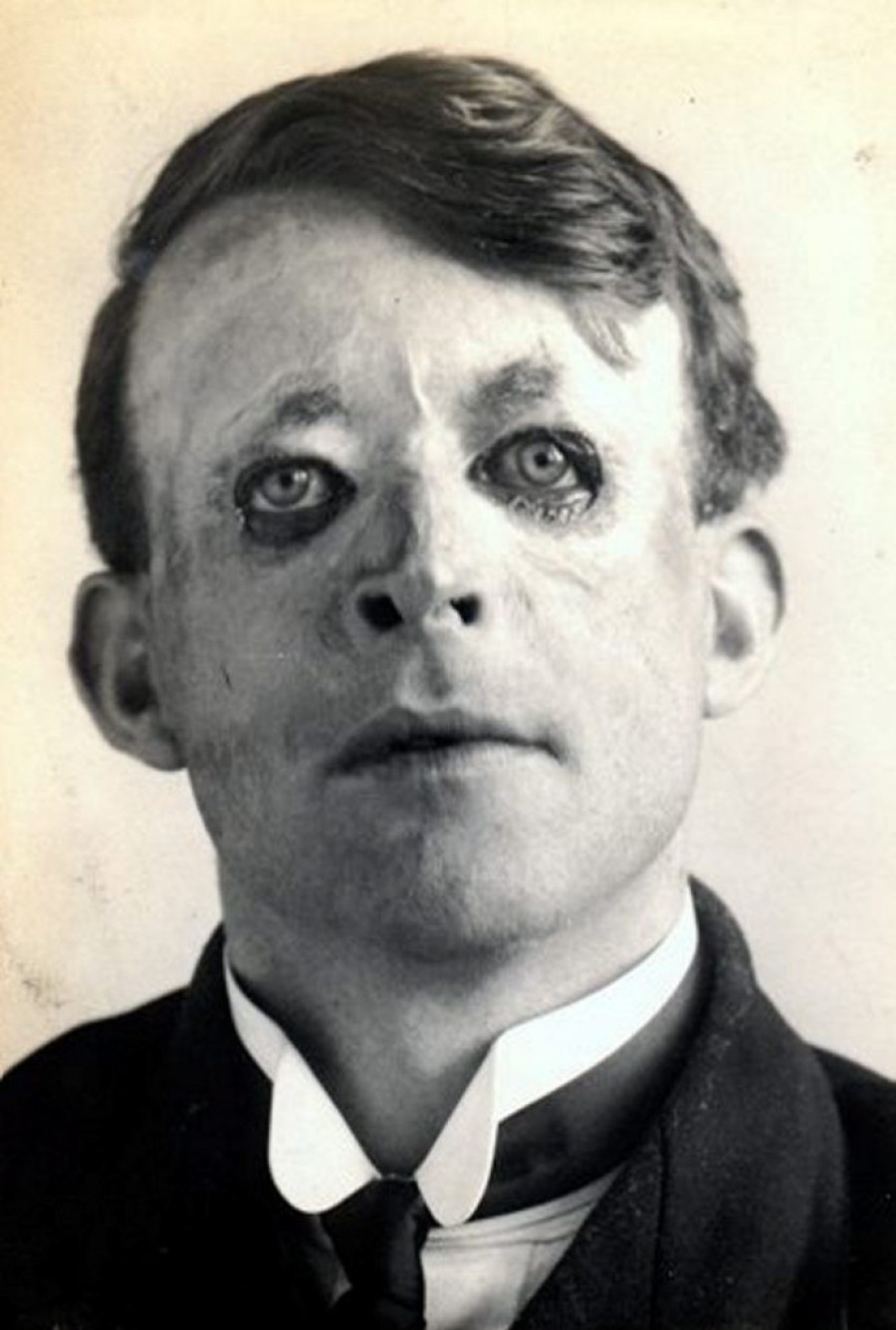 Mornar Valter Jeo je prva osoba u istoriji koja se podvrgla modernoj plastičnoj hirurgiji (FOTO)