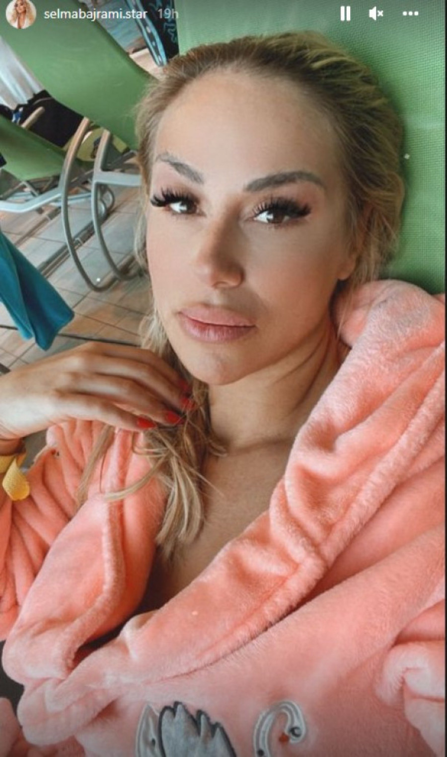 Pevačica ušla u petu deceniju, a ima lice dvadesetogodišnjakinje: Ispeglala se do maksimuma (FOTO)