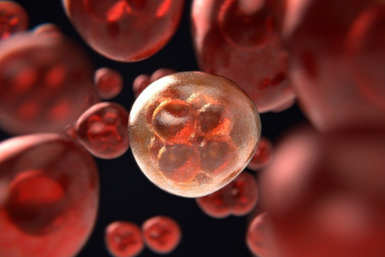 Leukemija je najpodmukliji oblik raka: Jedna vrednost tokom analize krvne slike ukazaće na veliki problem