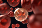 Leukemija je najpodmukliji oblik raka: Jedna vrednost tokom analize krvne slike ukazaće na veliki problem