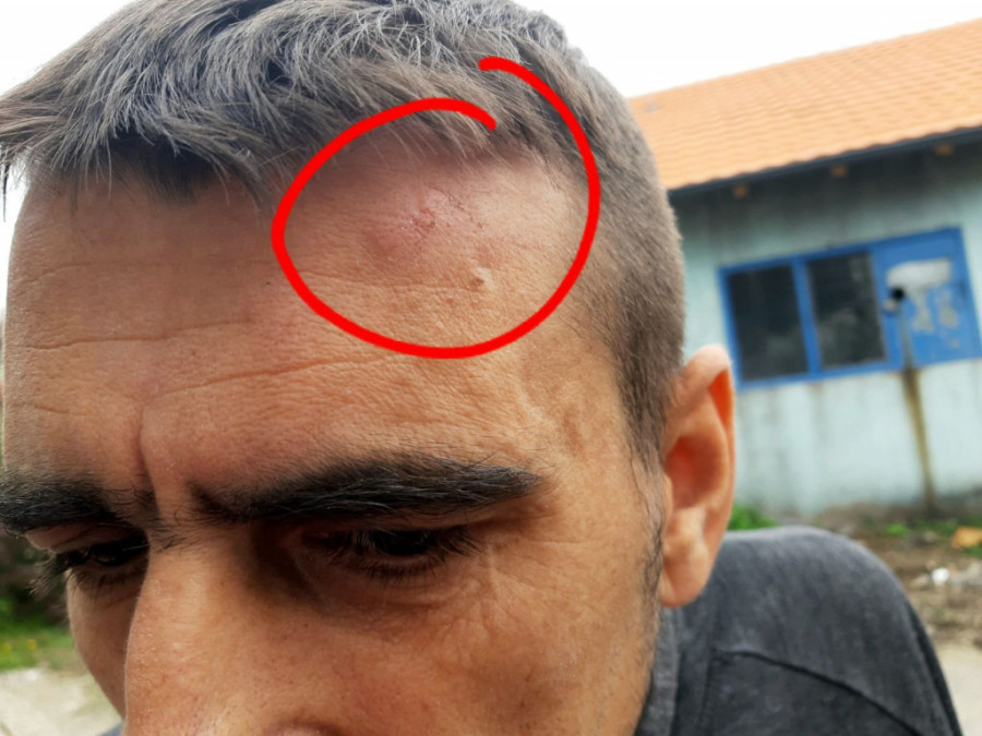 Sveštenikovom sinu razbio glavu, pa komšinici pretio: Agonija stanara Glamočke ulice nikad veća, pitaju se ima li kraja! (FOTO/VIDEO)