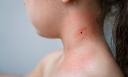 Alarmantno upozorenje lekarke: Opasnost vreba pred praznike, morate da potražite pomoć (VIDEO)