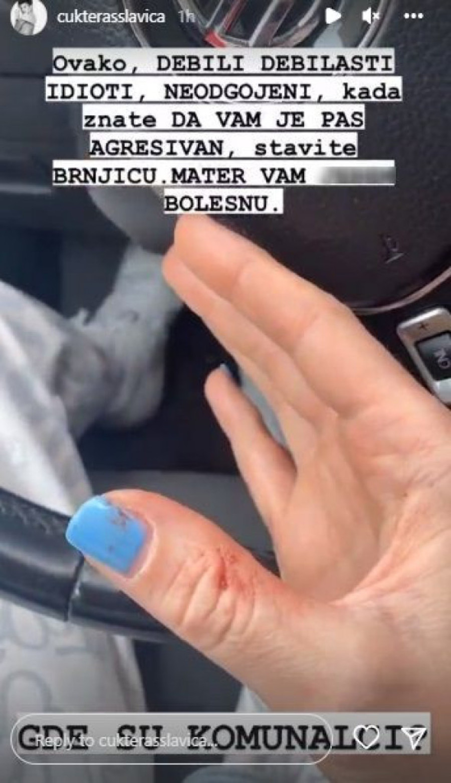 Estrada pod lupom 24sedam: Usponi i padovi od kojih boli glava! (FOTO)