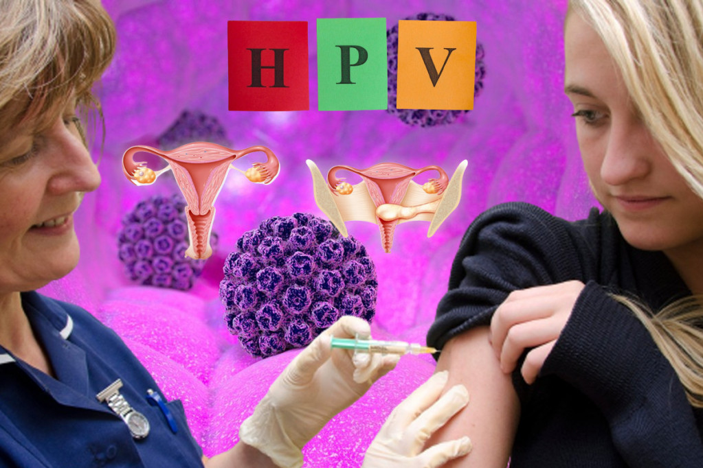 Da li Srbija može da dovede rak grlića materice na nivo statističke greške? Besplatna HPV vakcina je velika pobeda za roditelje!