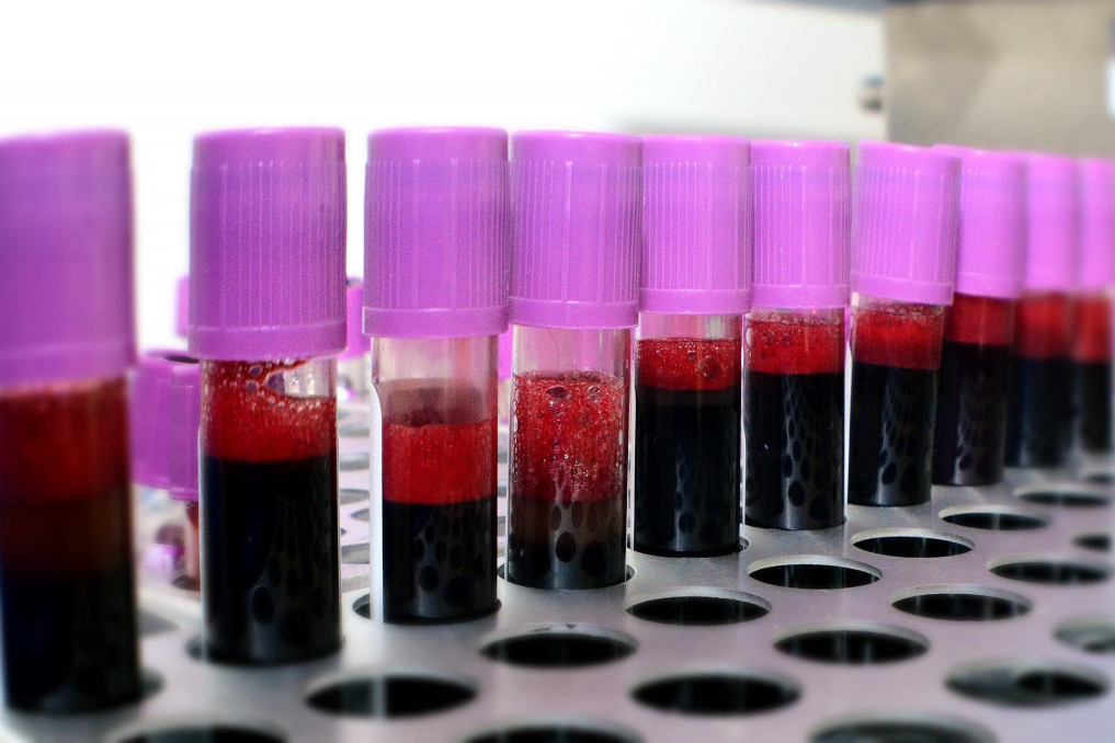 Pomozimo onima kojima je potrebno: Akcije davanja krvi na više lokacija u Beogradu tokom nedelje