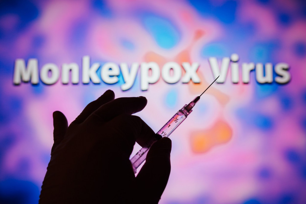 Italija počela vakcinaciju protiv majmunskih boginja:  Imunizacija usmerena na osobe sa najvećim rizikom od infekcije