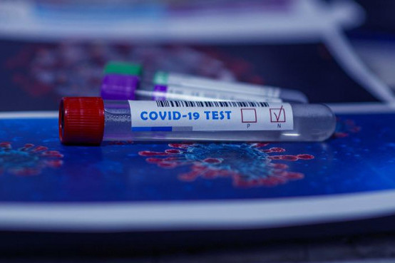 Doktori odahnuli: Pandemija koronavirusa u Srbiji stavljena pod kontrolu
