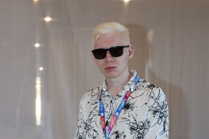 Albino o vršnjačkom nasilju i prihvatanju sebe: Počeo sam da se šalim na svoj račun