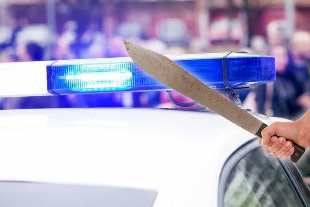 Muškarac pretučen i povređen mačetom na Zvezdari: Policija traga za napadačima