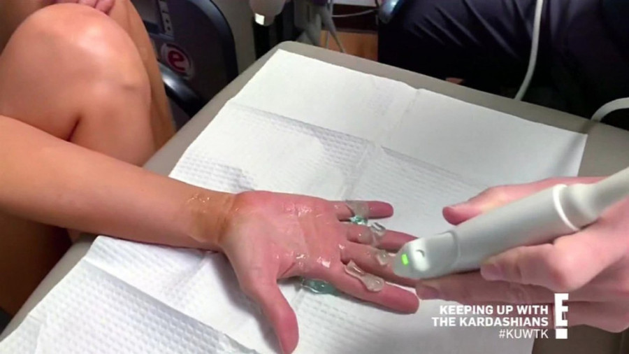 Kako se Kim u stvari nosi s ovim oboljenjem? Velika ispovest najpoznatije Kardašijanove: Nema više skrivanja šminkom!