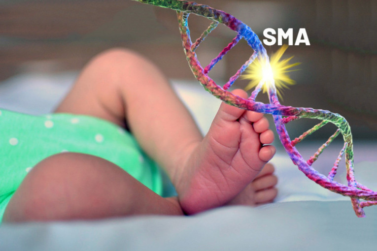Uskoro počinje skrining beba na genetsku mutaciju koja izaziva fatalnu bolest!