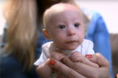 Beba rođena sa 450 grama sada ima 7 meseci i nosi odeću za lutke: Tek posle 3 meseca otkrili njegovu dijagnozu malog princa