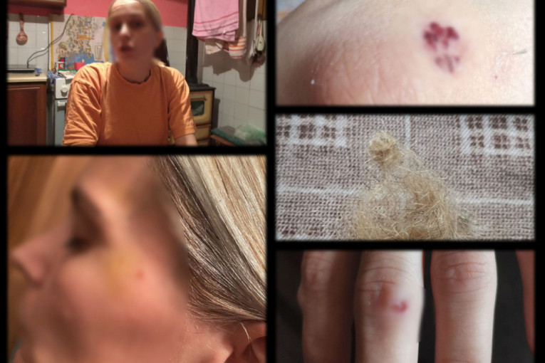 Maloletnica osuđena u Nišu: Pretukla medicinsku sestru i tražila joj novac!